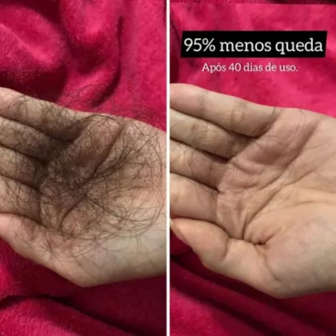 Comparação visual do efeito de um tratamento capilar: à esquerda, uma mão segura uma grande quantidade de fios de cabelo caídos; à direita, a mesma mão aparece sem fios, indicando redução significativa na queda após 40 dias de uso, com destaque para o texto “95% menos queda”.
