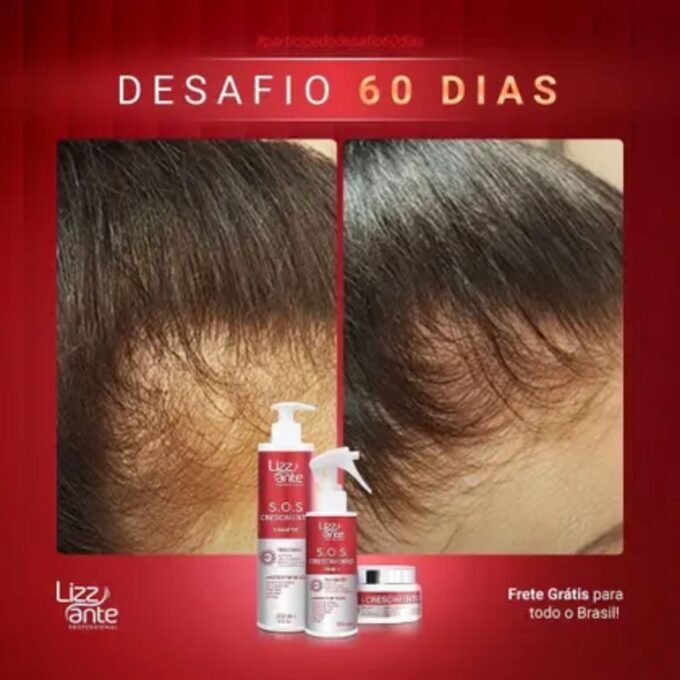 Imagem comparativa de antes e depois de um tratamento capilar com produtos Lizzy Cante: à esquerda, couro cabeludo com falhas e fios ralos; à direita, cabelo visivelmente mais cheio e saudável após 60 dias de uso, com destaque para os produtos da linha S.O.S Crescimento e o texto “Frete grátis para todo o Brasil”.