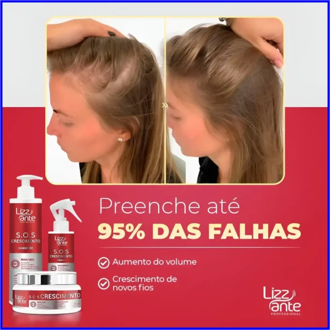 Imagem comparativa de antes e depois de um tratamento capilar com produtos Lizz Ante Professional: à esquerda, couro cabeludo com falhas visíveis; à direita, cabelo mais cheio e uniforme, com destaque para os textos “Preenche até 95% das falhas”, “Aumento do volume” e “Crescimento de novos fios”